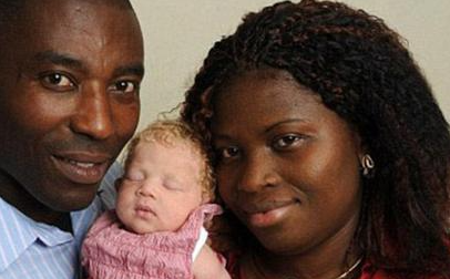 Как сейчас выглядит Белоснежка, которая 10 лет назад родилась в нигерийской семье